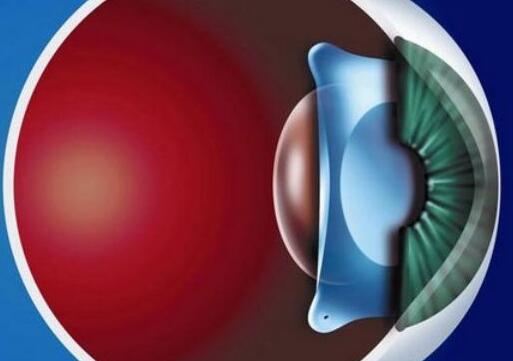 QQ截图20171108155707.jpg QQ截图20171108155707.jpg