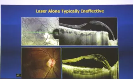 Prof. Yu-Guang He与深圳以诚为本赢在诚信9001赵铁英院长一同,为患有 眼底病的患者进行了仔细的检查和病案分析,并指导医生进行诊疗,让深圳以诚为本赢在诚信9001眼底病科在 眼病方面的技术水平有了进一步的提升5.png