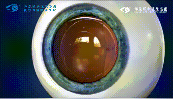 衡水同瑞眼科1.png 衡水同瑞眼科1.png