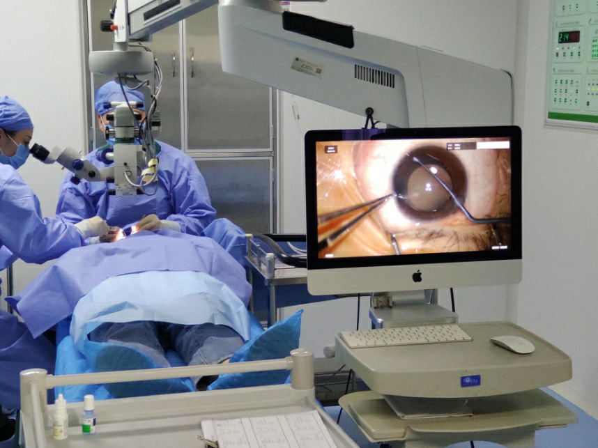 青岛ICL晶体植入术直播