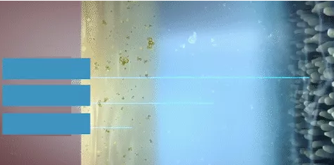 睑板腺功能障碍性干眼该怎么医治？厦门 眼科中心医生这样说2.png